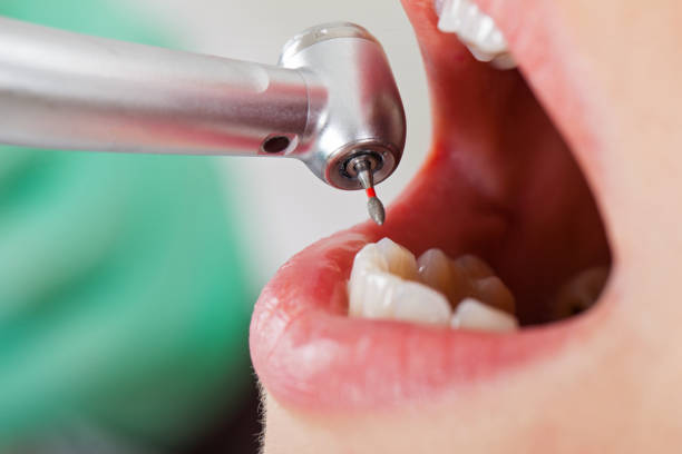 Best Pediatric Emergency Dentist in Dayton, TX